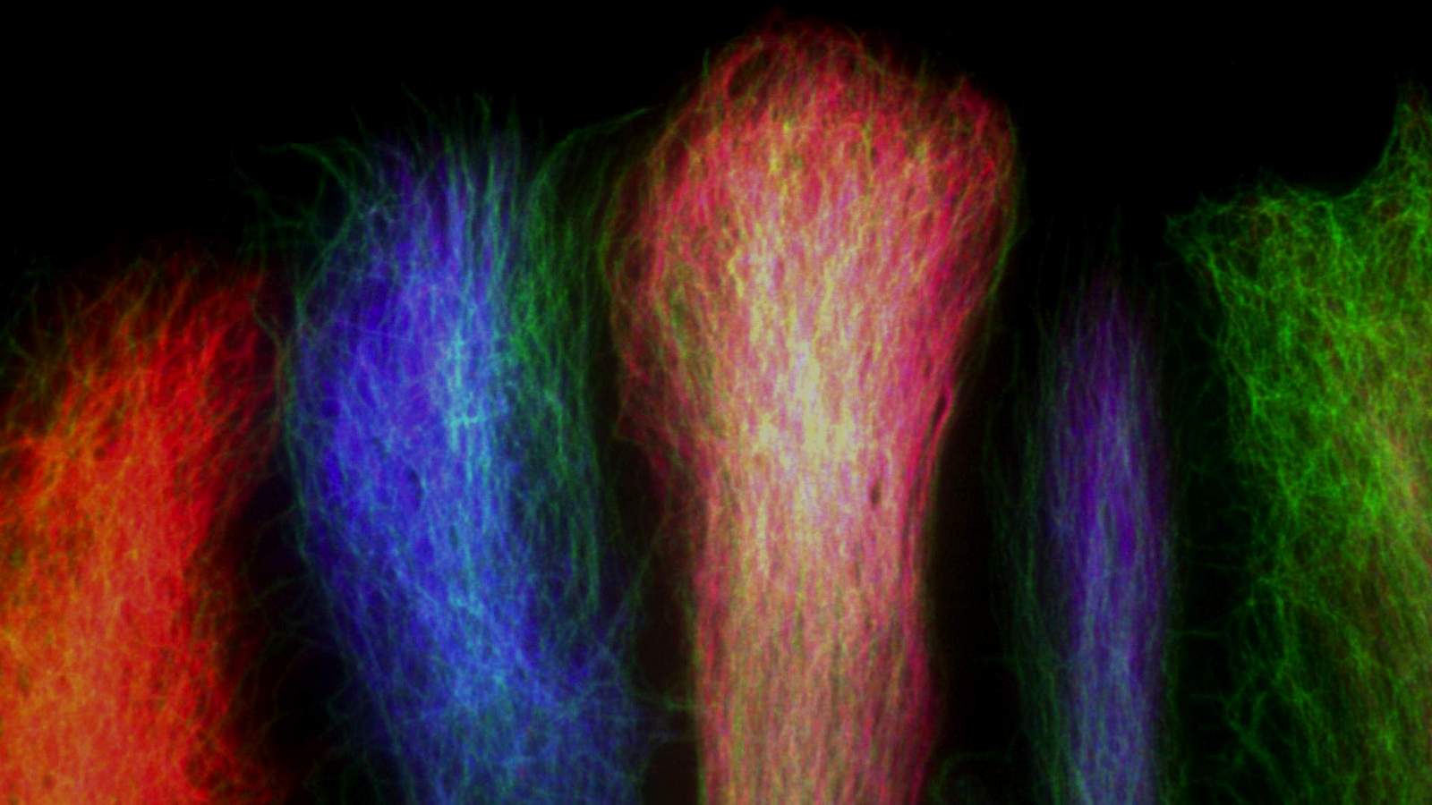 Dans des astrocytes en migration, les microtubules (en vert) et deux composants des filaments intermédiaires : GFAP (en rouge) et Nestin (en bleu). Imagerie en immunofluorescence.