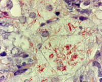 Mycobacterium tuberculosis intramacrophagiques
