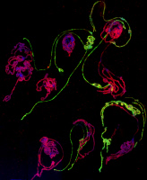 Etalement de chromosomes polytènes de glandes salivaires de drosophile