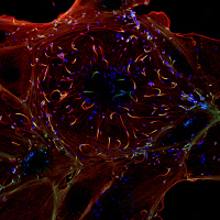 Cellule infectée par Listeria monocytogenes