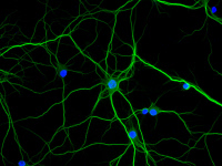 Neurones d'hippocampe de souris en culture utilisées pour la recherche sur les Encéphalopathies Spongiformes Transmissibles (EST)