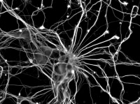 Neurones d'hippocampe de souris en culture