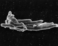 Mycobacterium tuberculosis, agent de la tuberculose