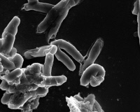 Mycobacterium tuberculosis, agent de la tuberculose