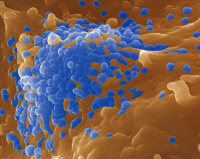 Particules du virus du Sida à la surface d'un lymphocyte