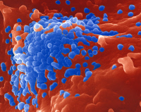 Particules du virus du Sida à la surface d'un lymphocyte