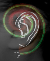 Immunomarquage (en vert) de l'otoferline, protéine des vésicules synaptiques des cellules sensorielles auditives