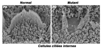 Touffe ciliaire dans un modèle murin du syndrome de Usher