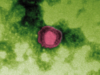 Virus Chikungunya en microscopie électronique à transmission