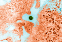 Virus de la dengue type 1 (au centre) infectant des cellules neuronales murines