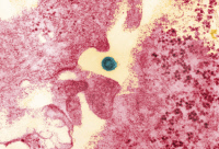 Virus de la dengue type 1 (en bleu) infectant des cellules neuronales murines