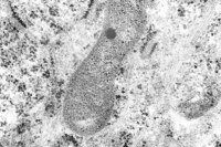 Cellules neuronales murines infectées par le virus de la dengue type 1