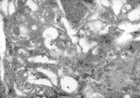 Cellules neuronales murines infectées par le virus de la dengue type 1