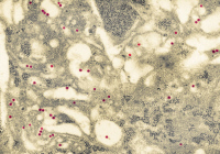 Virus de la dengue type 1 infectant des cellules neuronales murines