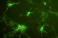 Cellules neurales infectées par virus West Nile.