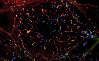 Cellule infectée par Listeria monocytogenes