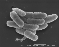 Bactéries Yersinia pestis en microscopie electronique à balayage