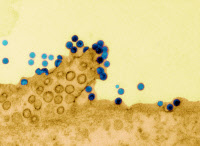 Virus Chikungunya bourgeonnant à la surface d'un fibroblaste humain infecté en culture.