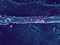 Virus chikungunya à la surface d'une cellule infectée