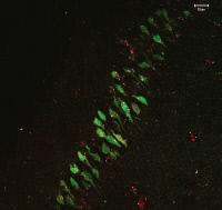 Tranche d'hippocampe de souris colorée avec deux toxines spécifiques de sous-types de récepteur nicotinique