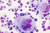 Cellules souches hématopoïétiques