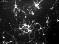 Visualisation des flux calciques dans une culture de neurones