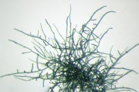 Cyanobactérie souche PCC 9401