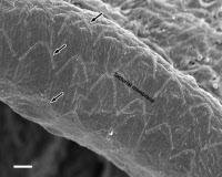 Vue en microscopie à balayage de la face inférieure de la membrane tectoriale