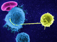 Contact entre un lymphocyte infecté par le VIH (en jaune) avec un lymphocyte non-infecté
