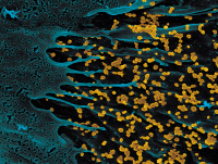 Virus Chikungunya (en jaune) à la surface d'une cellule infectée