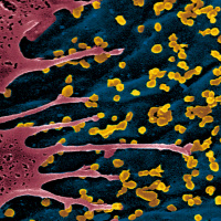 Particules du virus Chikungunya à la surface d'une cellule infectée