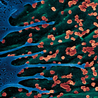 Particules du virus Chikungunya à la surface d'une cellule infectée