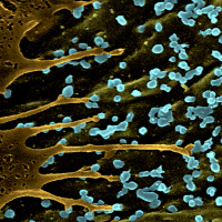 Virus Chikungunya à la surface d'une cellule