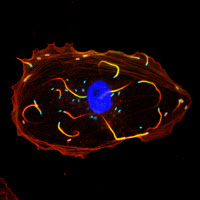 Cellule infectée par Listeria monocytogenes.en microscopie à fluorescence