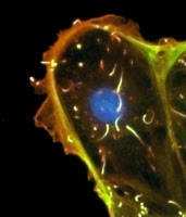 Observation en immunofluorescence d'une cellule infectée par Listeria monocytogenes