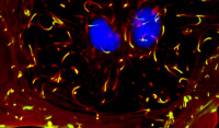 Observation en immunofluorescence d'une cellule infectée par Listeria monocytogenes