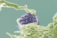 Interaction entre un lymphocyte T4 (en bleu) infecté par le HIV et une cellule dendritique (en vert)