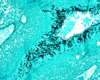 Coupe histologique d'un poumon murin infecté par Aspergillus fumigatus