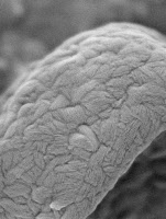 Détail de la surface d'une conidie d'Aspergillus fumigatus