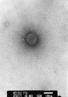 Coronavirus, agent du SRAS (Syndrome Respiratoire Aigu Sévère)