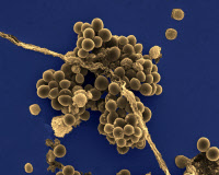 Bactéries Staphylococcus aureus (staphylocoque doré)