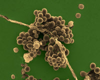 Staphylococcus aureus, staphylocoque doré