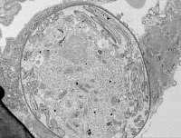 Oocyste et sporozoïtes de Plasmodium dans un estomac de moustique