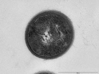 Streptococcus gallolyticus en microscopie électronique à transmission
