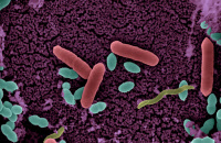 Adhérence de Salmonella typhimurium (en rouge) sur l'épithélium intestinal de souris