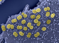 Neisseria meningitidis adhérant à la surface de cellules épithéliales
