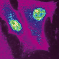 Protéine bactérienne LntA (en vert-jaune) localisée dans le noyau de deux cellules humaines infectées par Listeria (en violet-bleu)