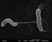 Bactéries Helicobacter pylori en microscopie électronique à balayage