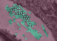 Virus de la grippe pandémique A (H1N1) 2009