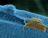Cellule souche (en jaune) de muscle squelettique migrant sur une fibre musculaire (en bleu)